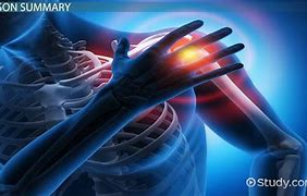 Image result for Supraspinatus and Infraspinatus Tendinopathy