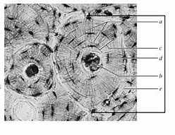 Image result for Osteon Labeling