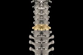 Image result for C6 Spinal