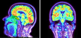 Image result for Open Pet Scan Machine