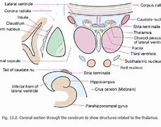 Image result for CT Brain Lentiform Nucleus