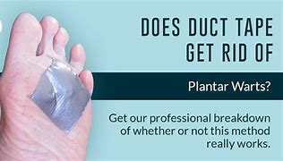 Image result for Plantar Wart Duct Tape