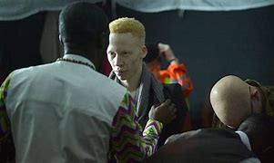 Image result for Albino Child in Pagent