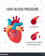 Image result for Google High Blood Pressure Image