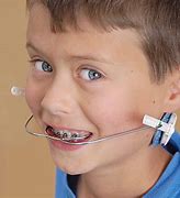 Image result for Full Orthodontic Headgear