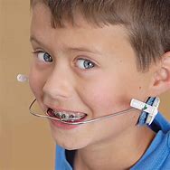 Image result for Orthodontic Headgear