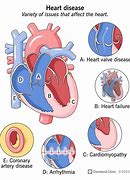 Image result for Heart Disease Photos