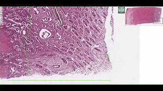 Image result for Uteres Histology