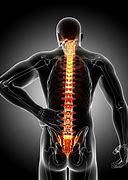 Image result for Lumbosacral Fusion