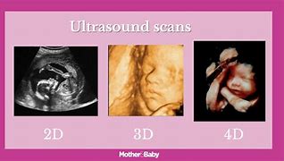 Image result for CT Baby Scan 3D