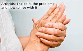 Image result for Bad Arthritis