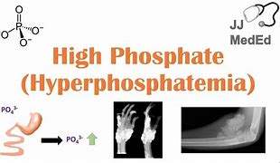 Image result for Hyperphosphorus Ddx