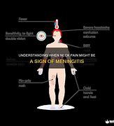 Image result for Meningitis Neck Pain