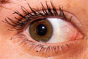 Image result for Human Eyeball