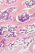 Image result for Cancellous Bone Spongy Bones