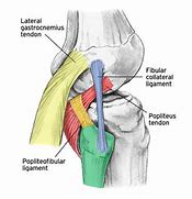 Image result for PA Oblique Lateral Rotation Knee