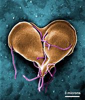 Image result for Protozoan Giardia Lamblia