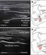 Image result for Mid Coronal Plane