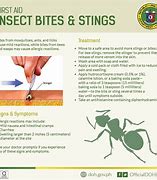 Image result for Treating Insect Bites