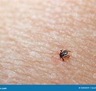 Image result for Tick Buried Under Skin