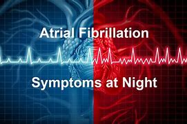 Image result for Vagal AFib Symptoms