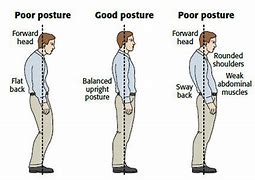 Image result for 5 Proper Standing Posture