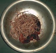 Image result for Parasitic Worms