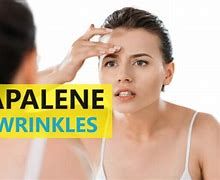 Image result for Adapalene for Wrinkles