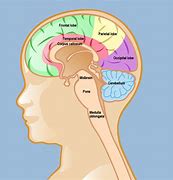 Image result for Tumor Near Brain Stem