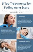 Image result for What Helps with Acne Scars