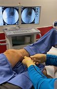 Image result for Intraosseous