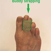 Image result for Greyhound Dislocated Toe