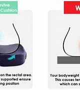 Image result for Cushion for Rectal Cancer