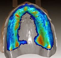 Image result for CAD/CAM Dentures