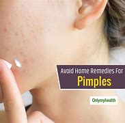 Image result for Pimples to Non Pimples