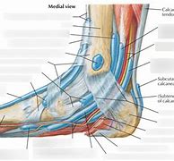 Image result for Flexor Retinaculum Ankle Thicking