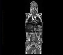 Image result for Whole Body MRI Angio