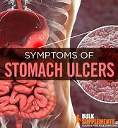 Image result for Stomach Ulcer Pain Relief