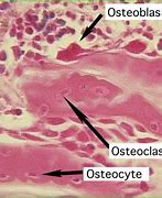 Image result for Osteoblasts in Bone