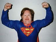 Image result for Down Syndrome Superman