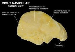 Image result for Talus Navicular