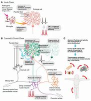 Image result for Acute Ataxia