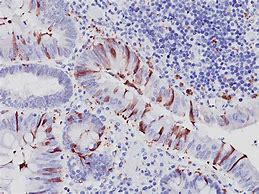 Image result for Caspase Antibody