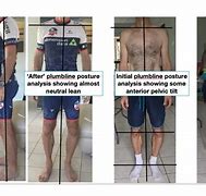 Image result for Standing Posture Plumb Line