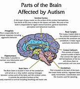 Image result for Autism vs Non Autism