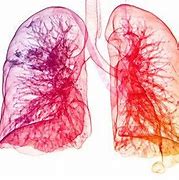 Image result for Pleural Diseases