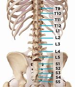 Image result for T12-L1 Back Pain