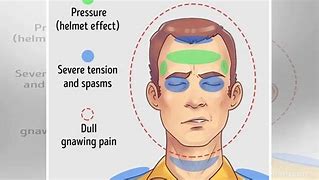 Image result for Headache Left Side of Head