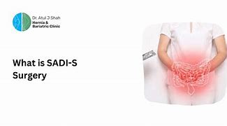 Image result for Sadi S Surgery