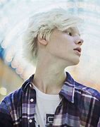 Image result for Albino Boy